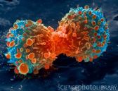 Lung cancer cell division, SEM